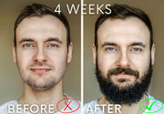 1 Month Supply - Beard Growth Serum - New Gen Studio